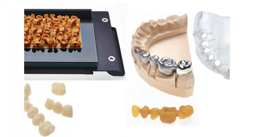 Applicazioni di stampa 3D per il dentale